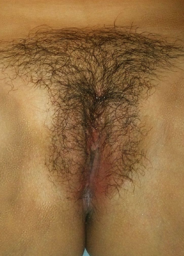 Genital Warts: after homeopathic treatment